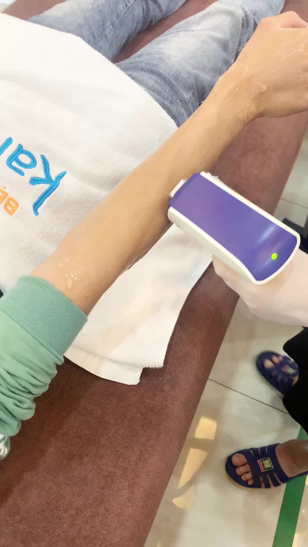 Triệt lông cực hiệu quả với công nghệ Diode Laser tại Kangnam - Sau một liệu trình, tạm biệt lông tay