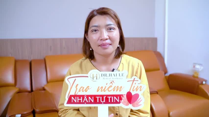 Hô biến mí to thành mí nhỏ đẹp ngay tức thì mời cả nhà đón xem