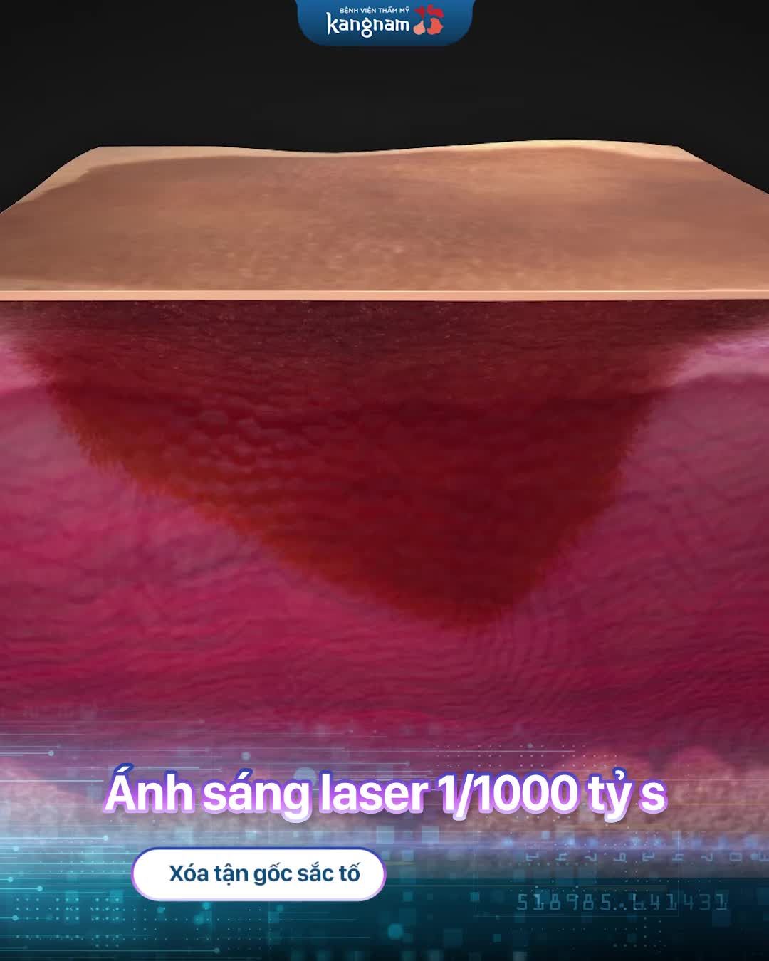 Tại sao Laser Picosure có thể xóa sổ tàn nhang - sắc tố ở dưới da mà không làm tổn thương da
