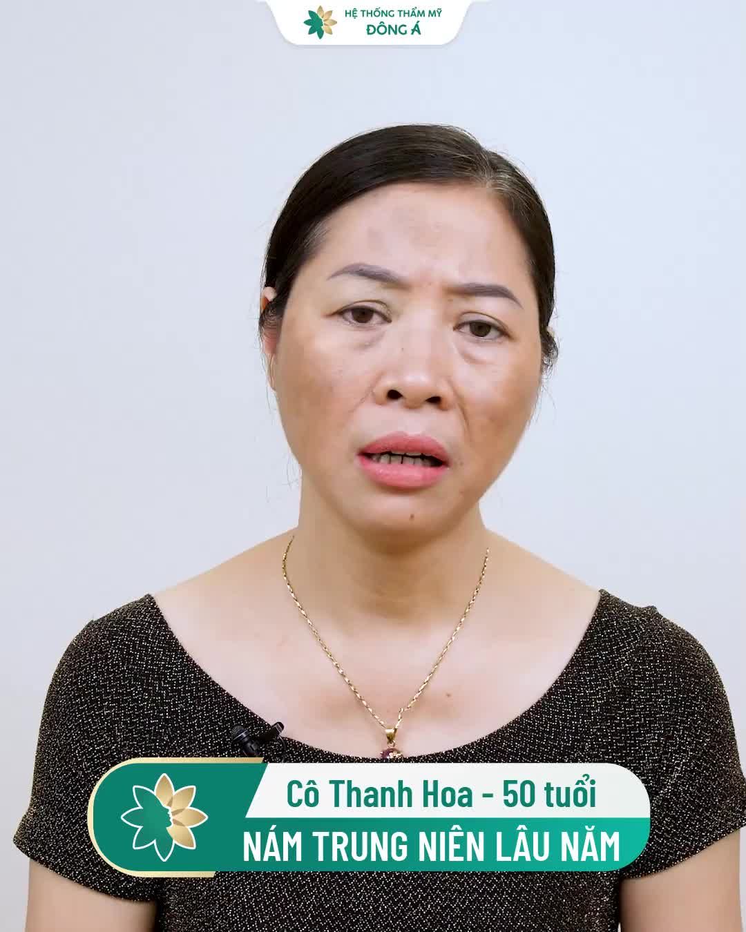 10 năm sống chung với Nám do dùng kem trị Nám rởm của các bác sĩ mạng và cái kết!