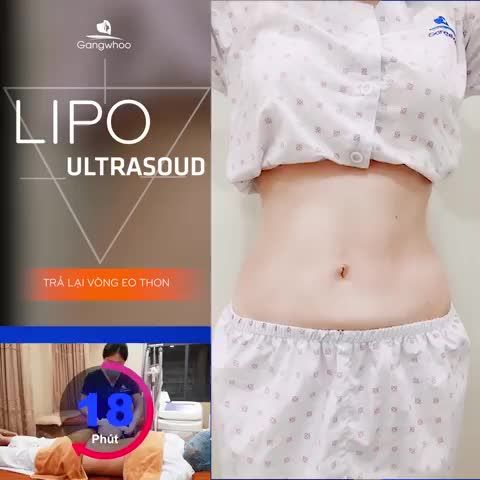 LIPO ULTRASOUD - VÓC DÁNG THON GỌN VỚI 60 PHÚT