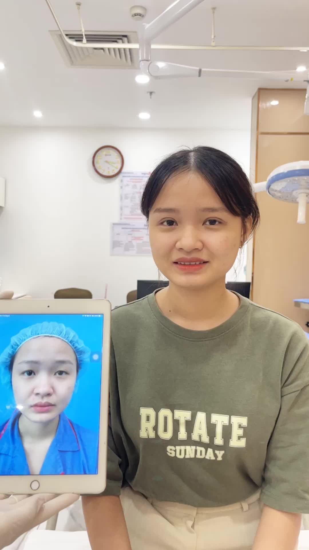Sở hữu đôi mắt đẹp và to tròn cùng công nghệ Cắt mí Plasma tại Kangnam