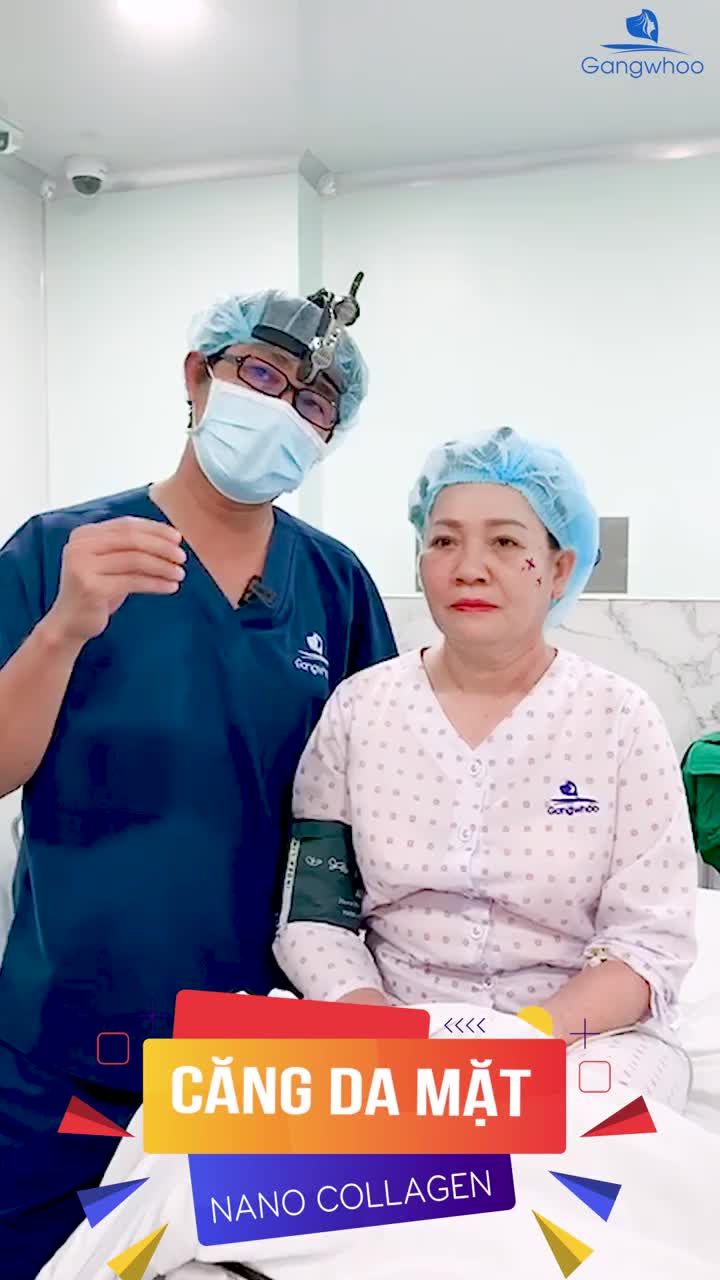 CĂNG DA MẶT BẰNG CHỈ NANO COLLAGEN - DA HỒI XUÂN SAU 60 PHÚT