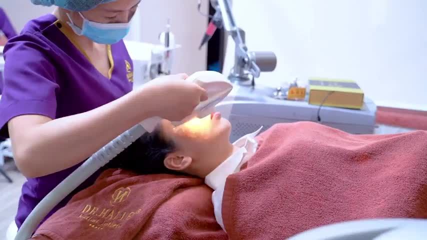 Trị tàn nhang bằng công nghệ ánh sáng Elos tối ưu liệu trình, 1 lần điều trị cam kết khỏi hoàn toàn