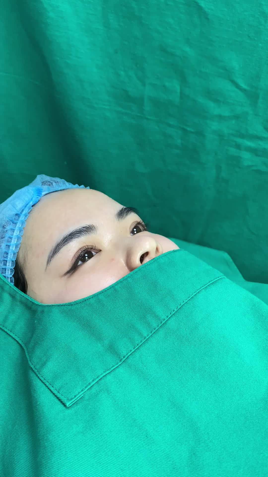 Phân tích tình trạng mũi khách hàng