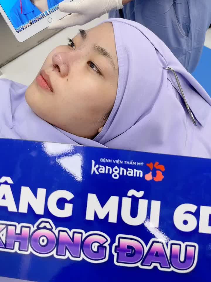 Kết quả nâng mũi 6D không đau siêu đẹp, siêu thay đổi của nữ khách hàng tại Kangnam Sài Gòn