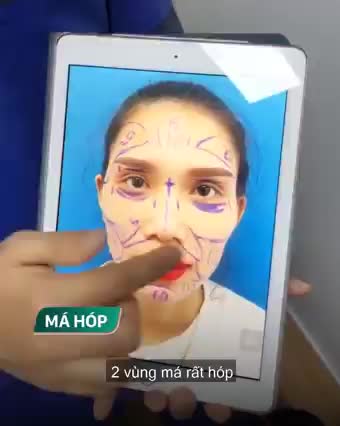 MÁ HÓP THÁI DƯƠNG LÕM MẶT THIẾU SỨC SỐNG!