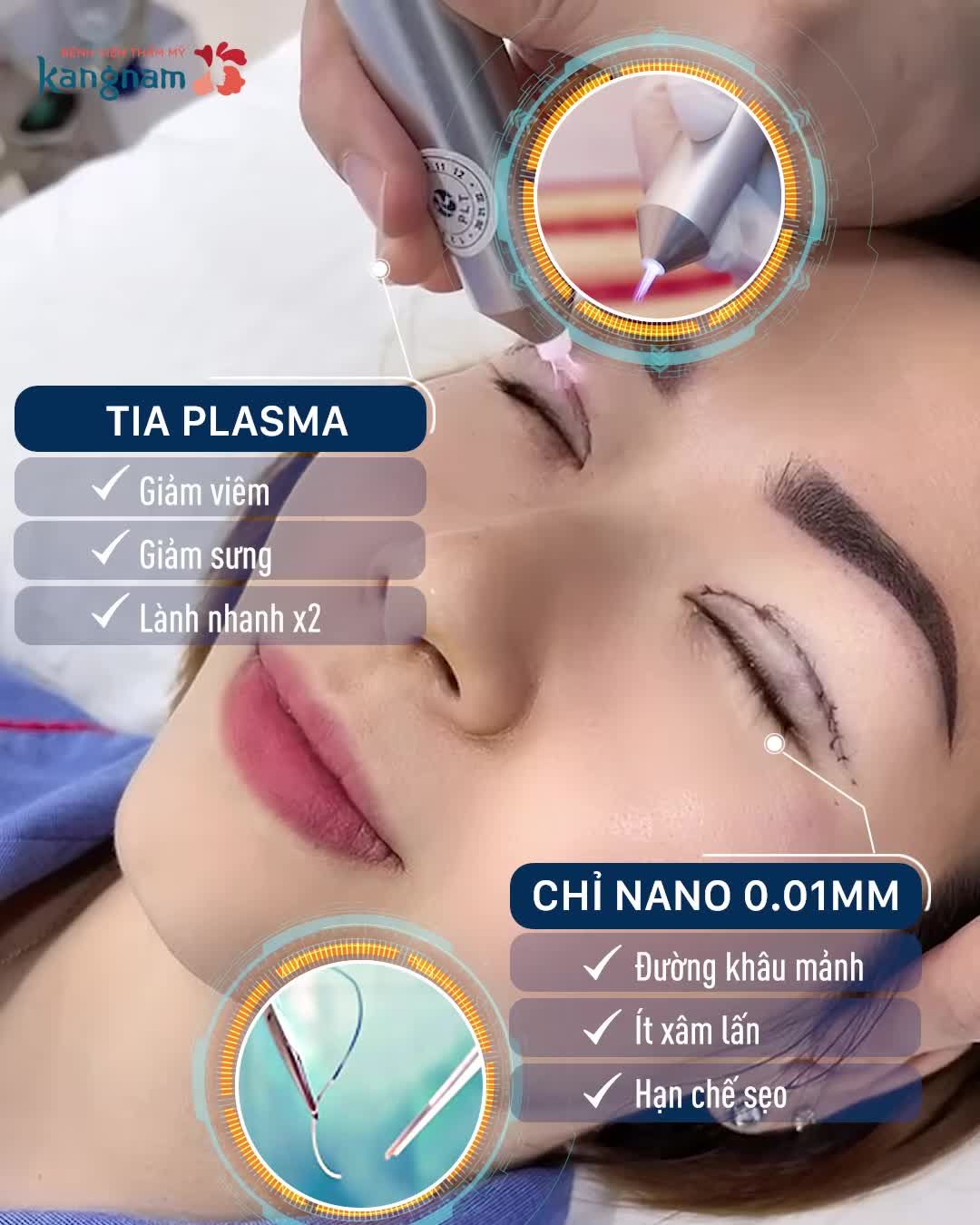 MỚI Ra mắt Công nghệ Cắt mí 6D KHÔNG SẸO