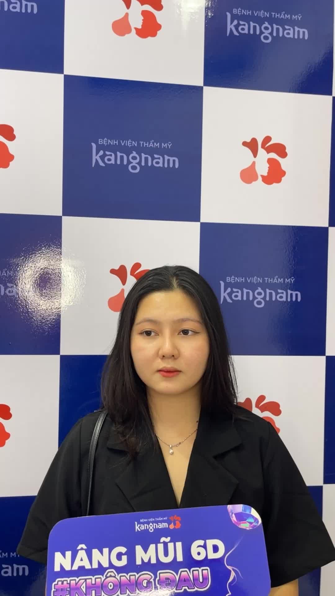 Kh nâng mũi Sline 6D sugifrom tái khám sau 1 tháng