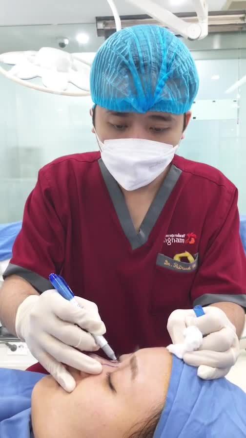 Có chị em nào muốn xem quy trình thực hiện nâng mũi sẽ diễn ra như thế nào không
