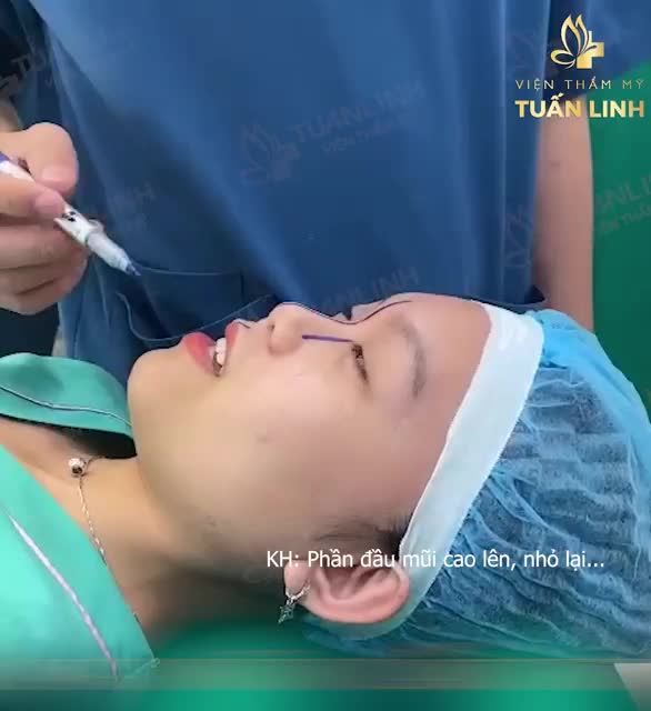 ''Em thích dáng mũi thật tự nhiên, phần đầu mũi cao bay, sống mũi thon gọn...Nhưng bác phải làm cho em thật tự nhiên nhé'' - Yêu cầu của khách hàng trước phẫu thuật.