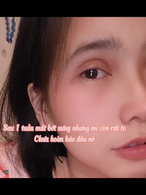 KHOAN KHOAN DỪNG KHOẢNG CHỪNG 2S ĐỂ ĐỔI THAY CUỘC ĐỜI