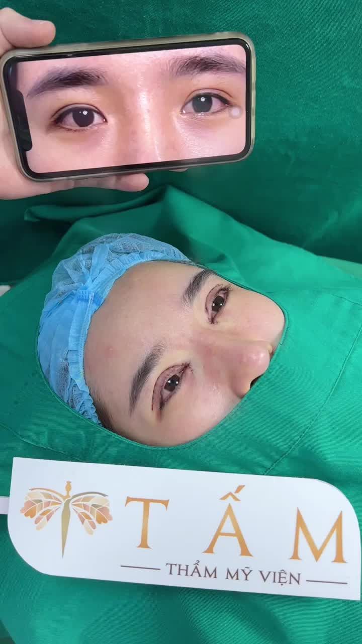 Triển ngay Combo cắt mí mở góc trong Perfect Eyes khi được bác sĩ tư vấn kĩ càng. Điều khách hàng nhận được sau 40 phút thực hiện là gì