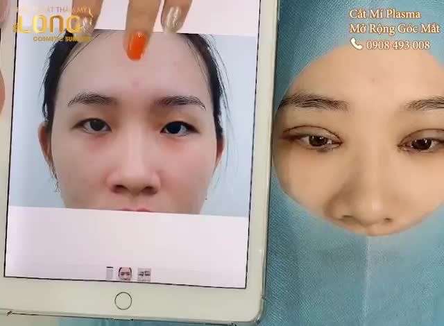 30 PHÚT CHO RA SẢN PHẨM MẮT 2 MÍ