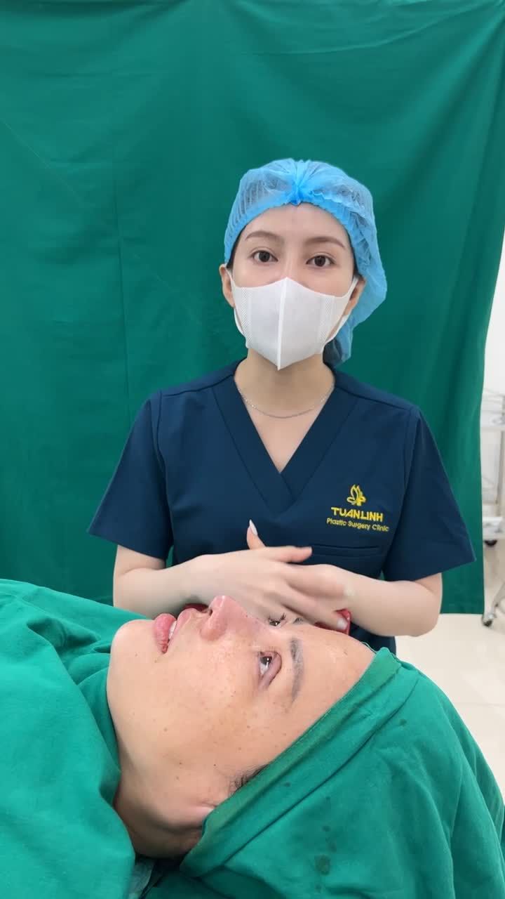 COMBO NÂNG MŨI SỬA LẠI + CẮT MÍ + ĐỘN CẰM SAU 2 TIẾNG PHẪU THUẬT