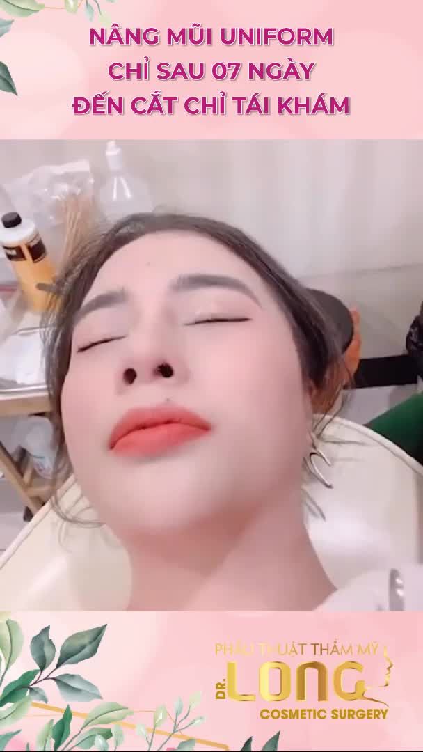 KẾT QUẢ DÁNG MŨI SAU 7 NGÀY