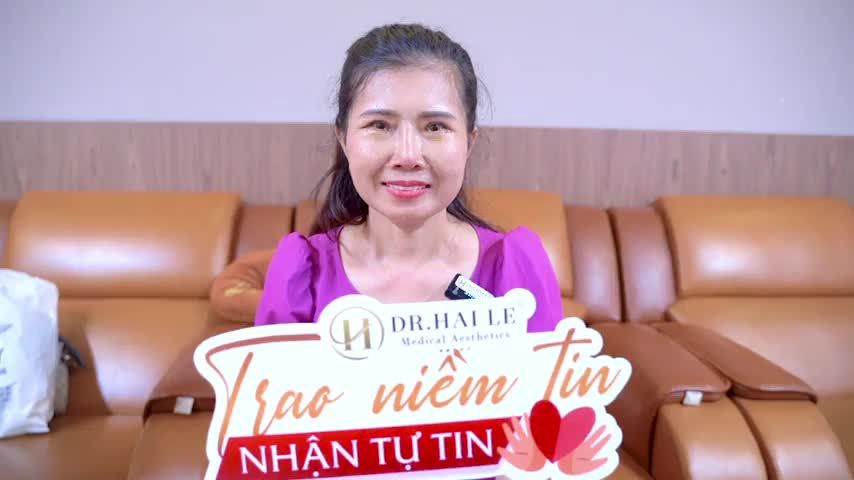 Nâng cung mày + Cắt mí dưới sau 7 ngày thực hiện vị khách hàng chia sẻ kinh nghiệm chăm sóc hậu phẫu như thế nào