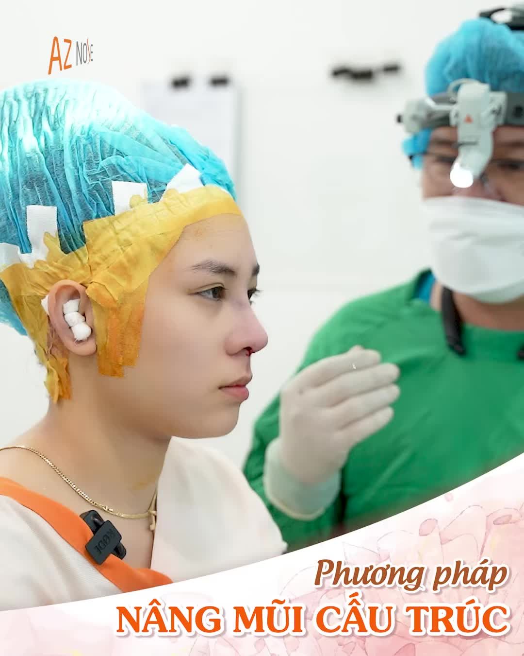 Dáng mũi Sline tự nhiên cho nàng thích khuôn mặt hiền