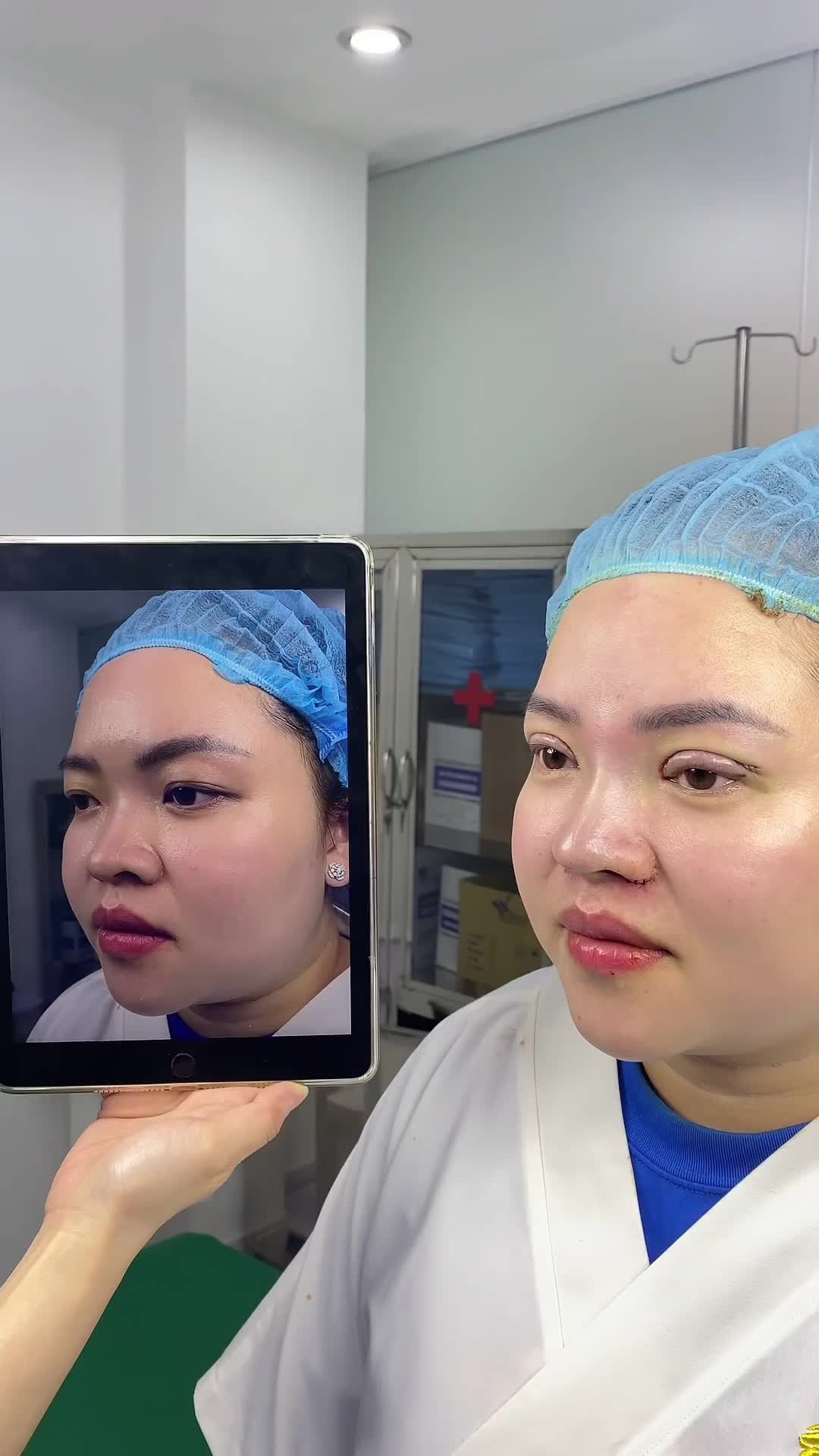 Khách hàng hài lòng thế nào với combo nâng mũi - cắt mí tại Thẩm mỹ viện Tấm
