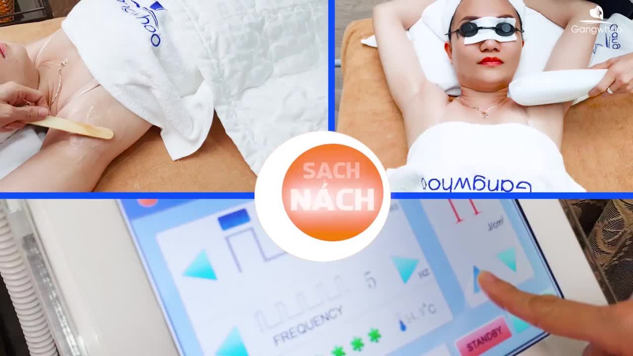 TRIỆT LÔNG…… KHÔNG THÀNH VẤN ĐỀ!