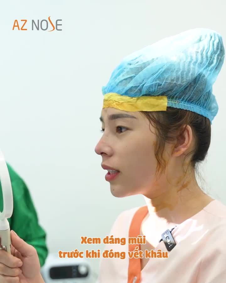 Cô nàng Bình Định thay đổi sau ca nâng mũi cấu trúc