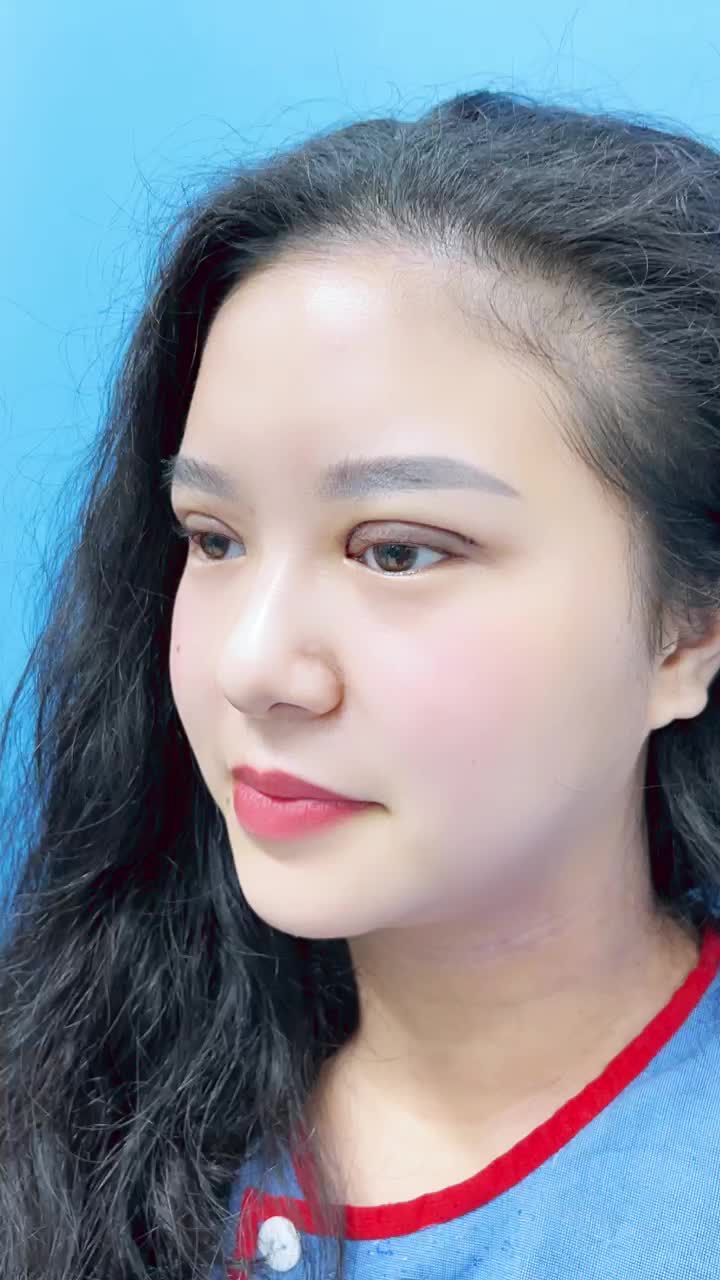 Nữ khách hàng Việt Kiều Anh tranh thủ về Kangnam cắt mí và nhận cái kết SỐC