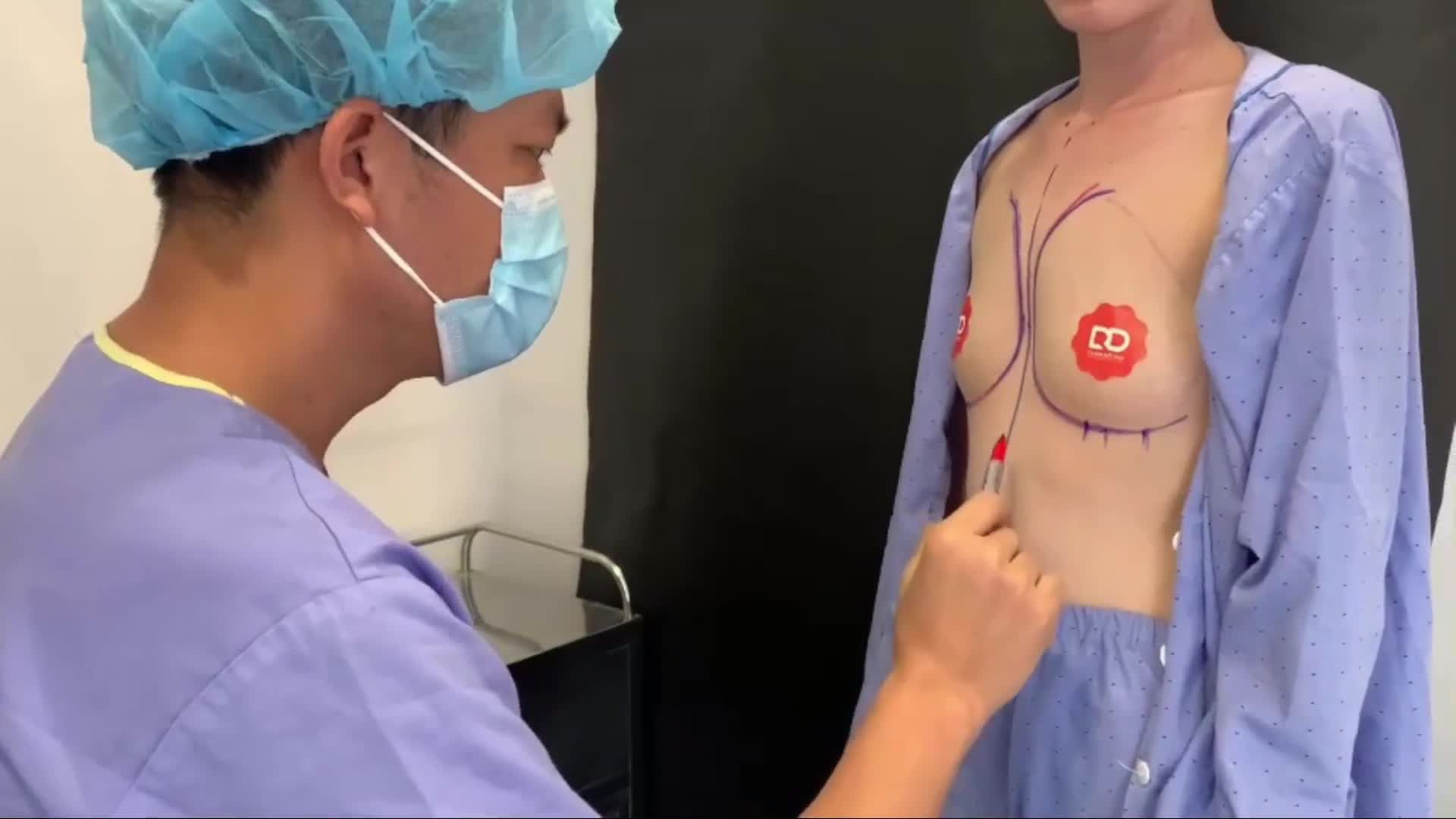 BS PHÂN TÍCH TÌNH TRẠNG NGỰC TRƯỚC PHẪU THUẬT NÂNG V1