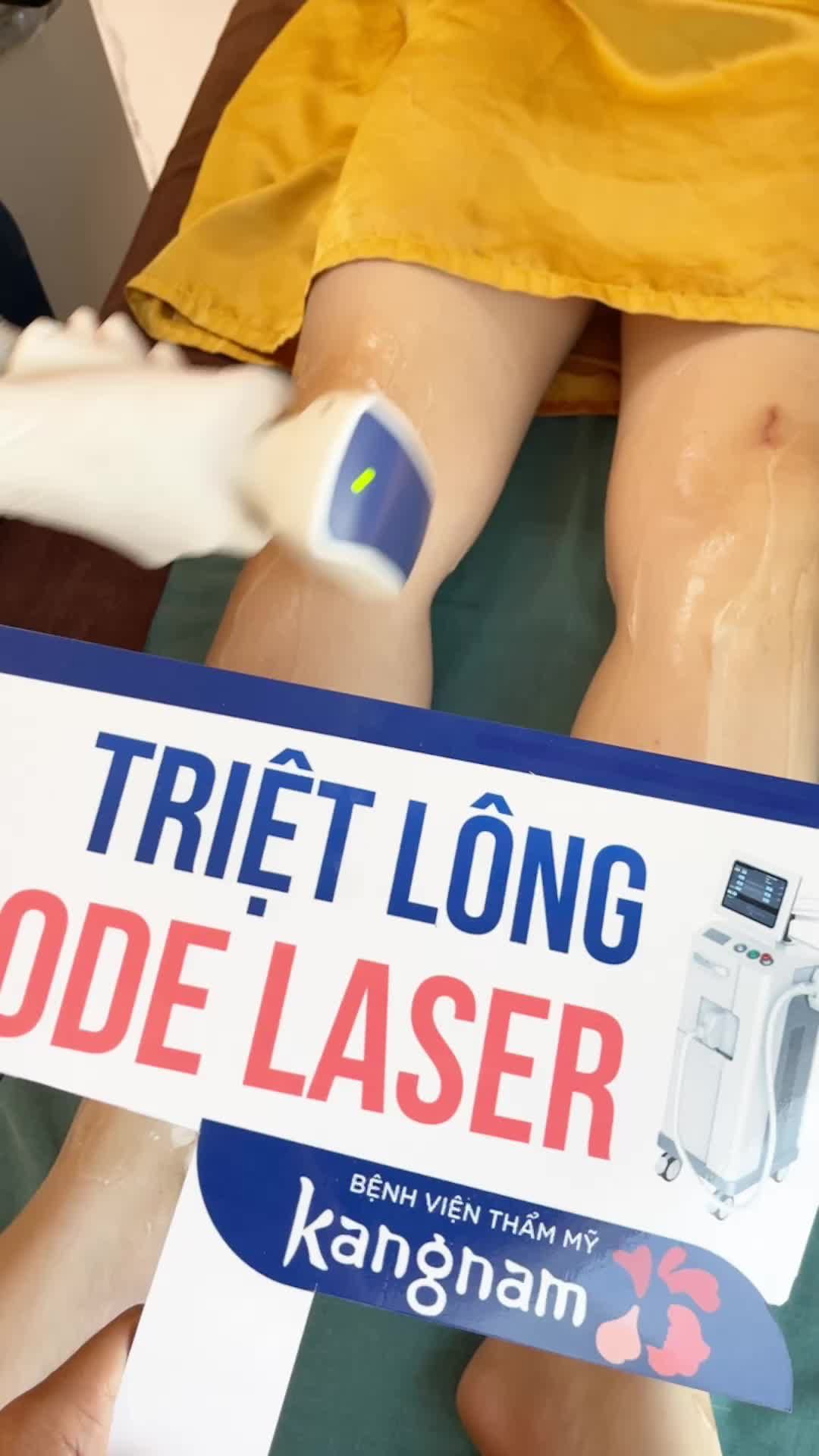 Triệt lông hiệu quả cùng công nghệ Diode Laser Tại Kangnam