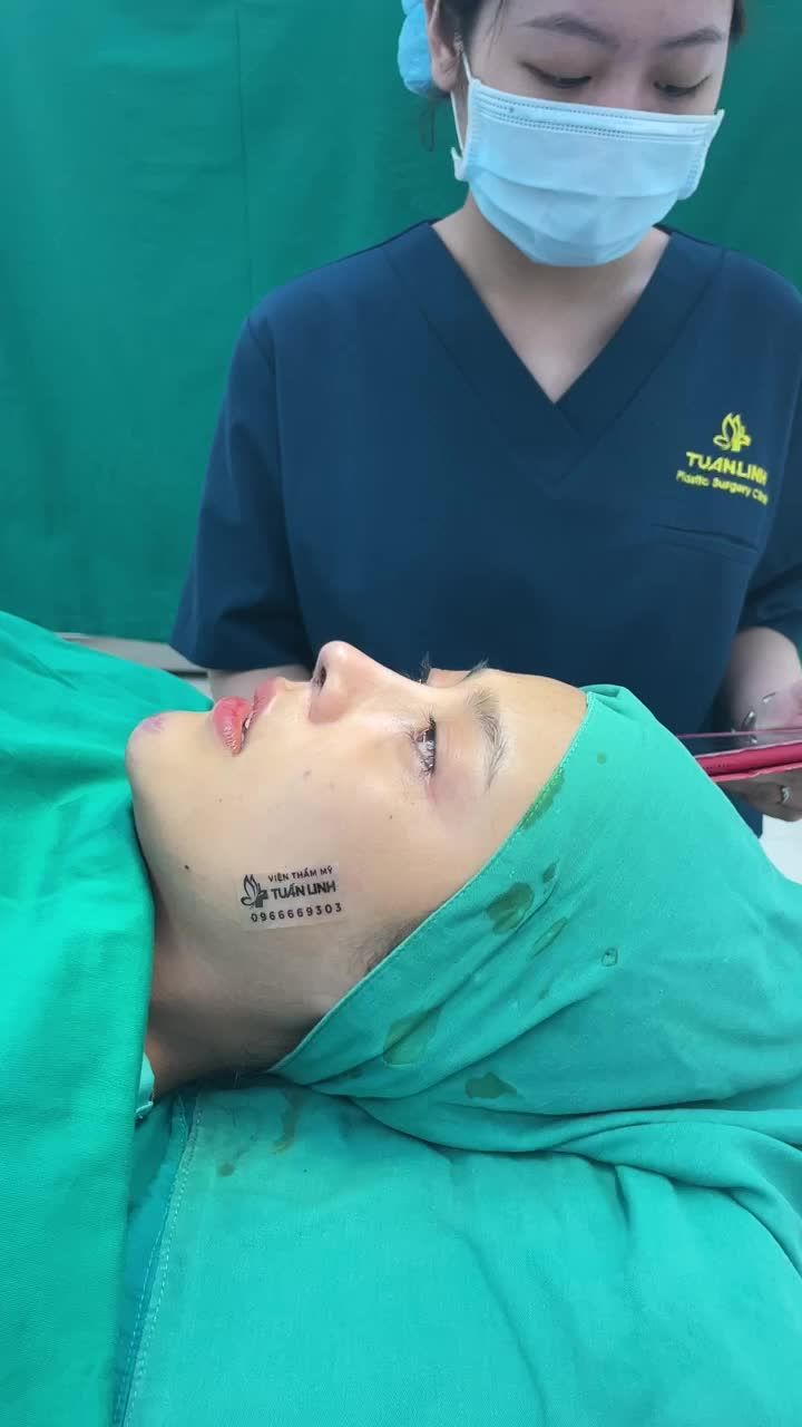 Dáng mũi 10 điểm dành cho bạn gái đến từ Bình Dương