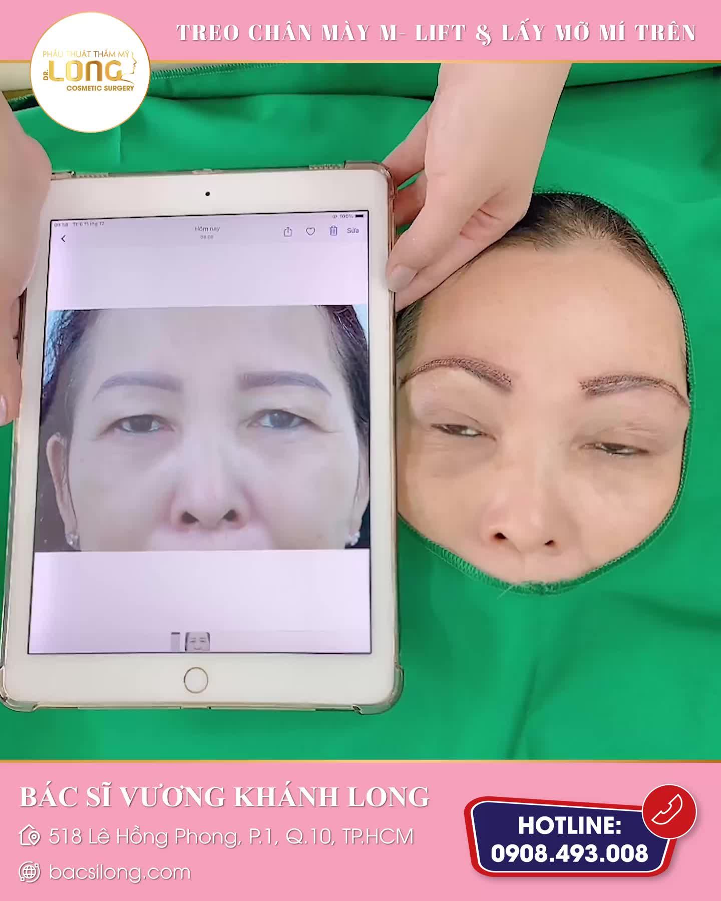 Đố cả nhà “TREO” gì để ngày càng trẻ và đẹp