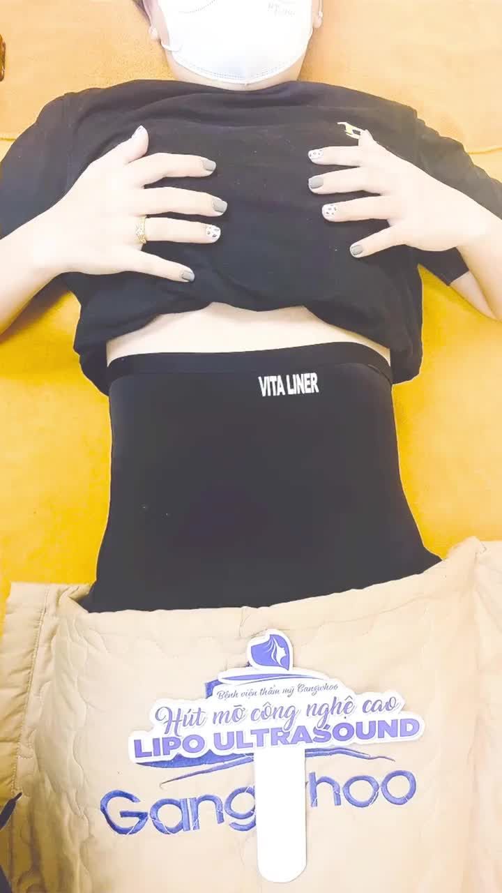 Chị khách hàng đến tái khám sau 7 ngày cho chị khi thực hiện dịch vụ hút mỡ công nghệ cao Lipo Ultrasound