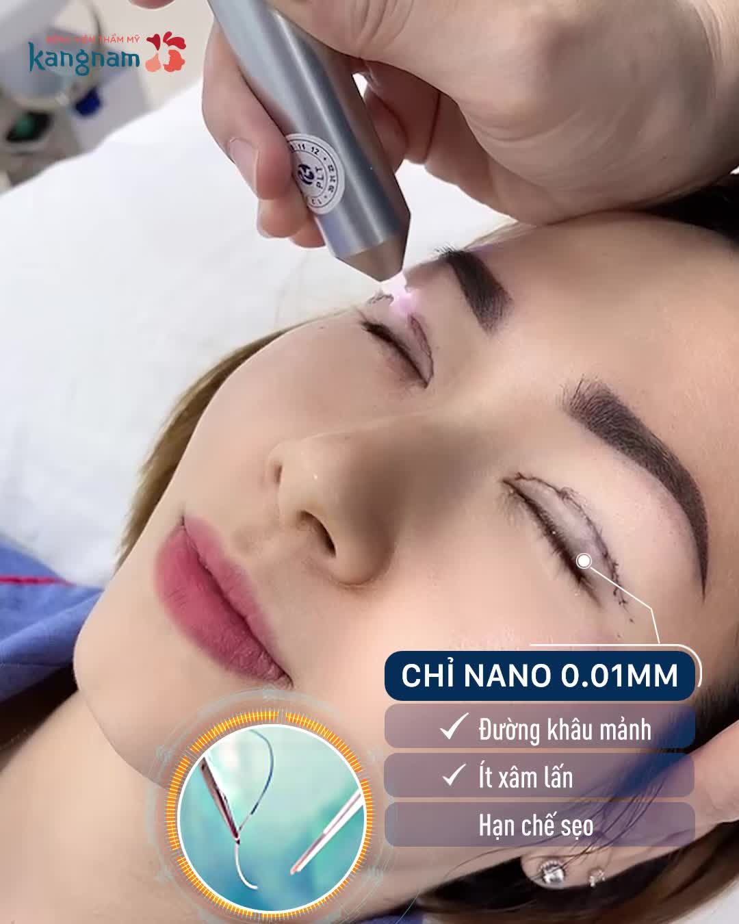 Ra mắt Công nghệ Cắt mí 6D KHÔNG SẸO