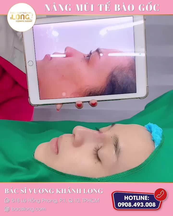 Chính tay bác sĩ Long thăm khám, tư vấn và thực hiện phẫu thuật nâng mũi