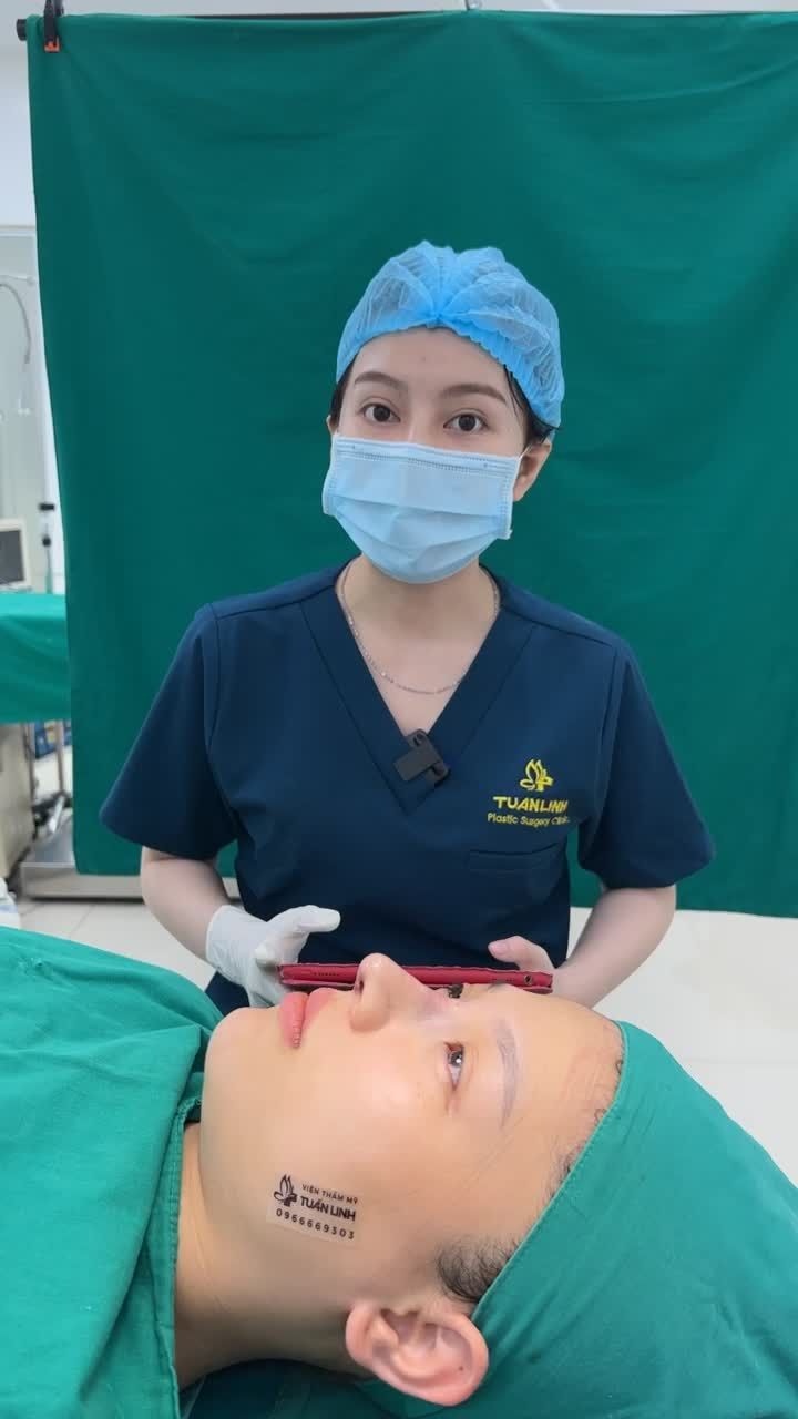 Đã từng nâng mũi chỉ + tiêm filler nhưng vẫn không hài lòng về dáng mũi... Bạn chọn phẫu thuật nâng mũi tại Tuấn Linh và kết quả.