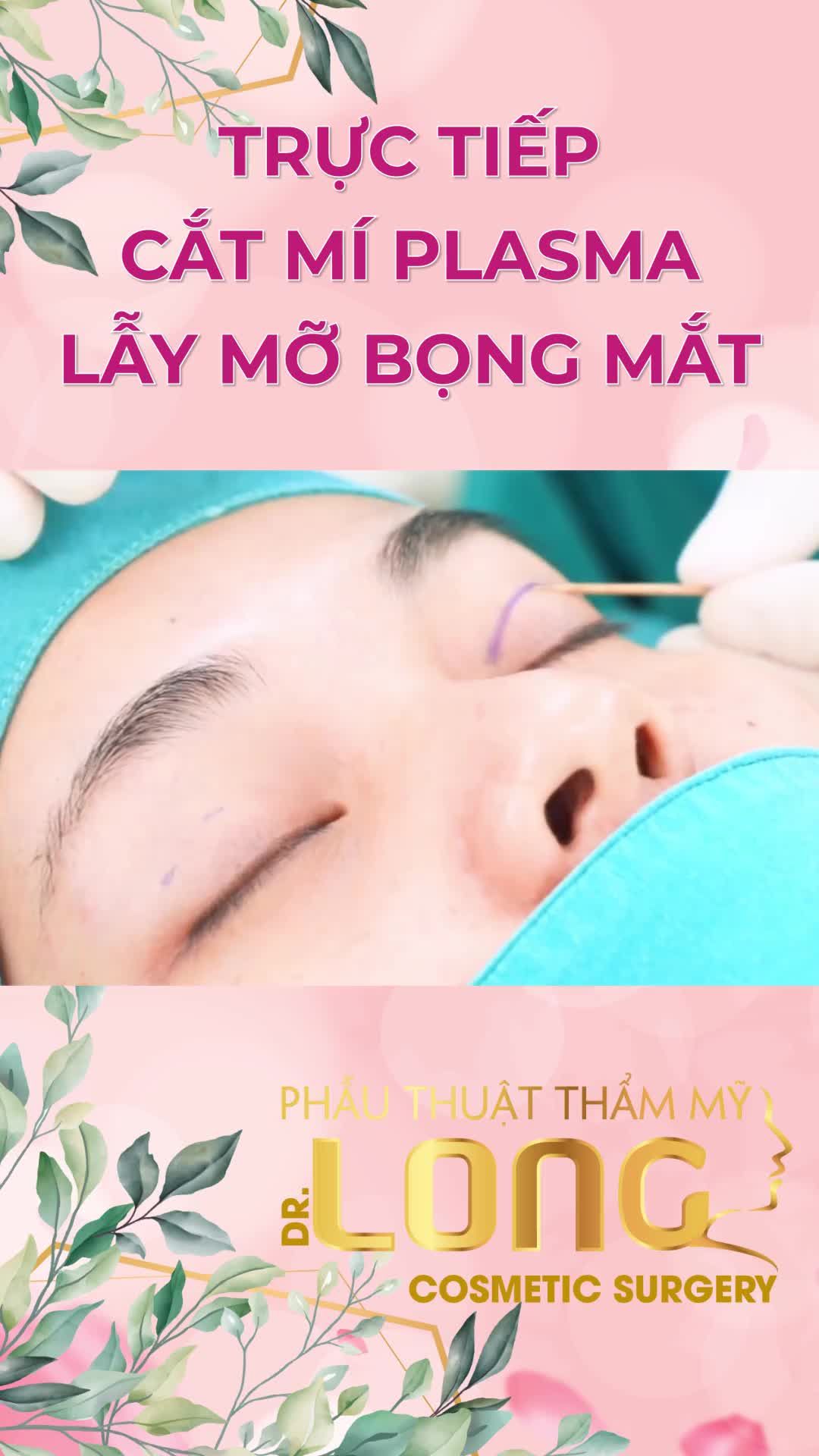 Cắt mắt plasma, lấy mỡ bọng mắt= Giải pháp toàn diện cho đôi mắt trẻ đẹp