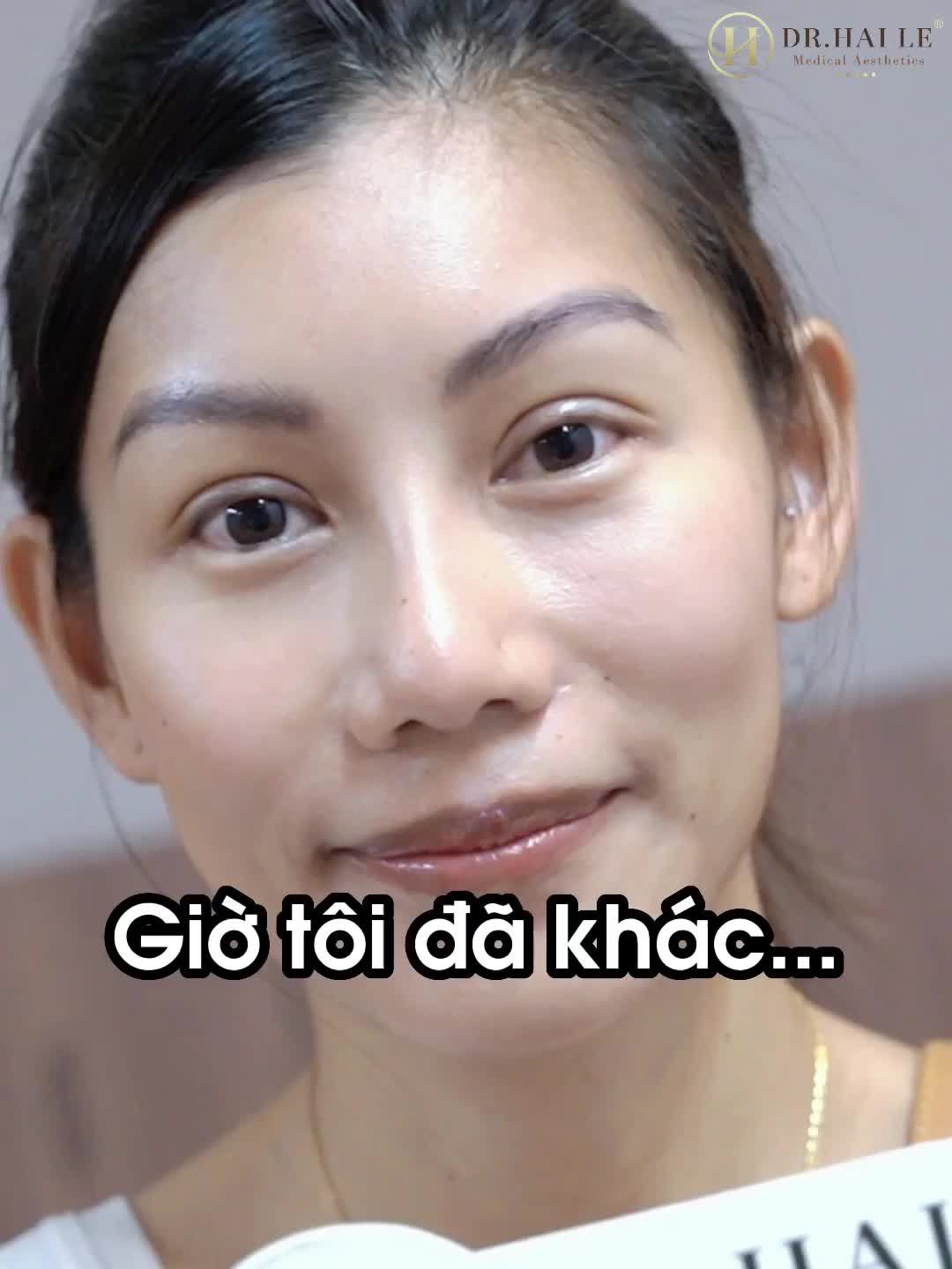 CẮT MÍ DR.HẢI LÊ - VẺ ĐẸP TỎA SÁNG TỪ ĐÔI MẮT