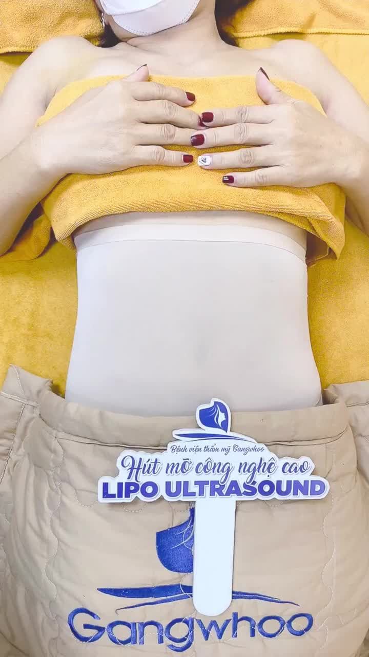 Chị khách hàng đến tái khám sau 7 ngày cho chị khi thực hiện dịch vụ hút mỡ công nghệ cao Lipo Ultrasound toàn thân