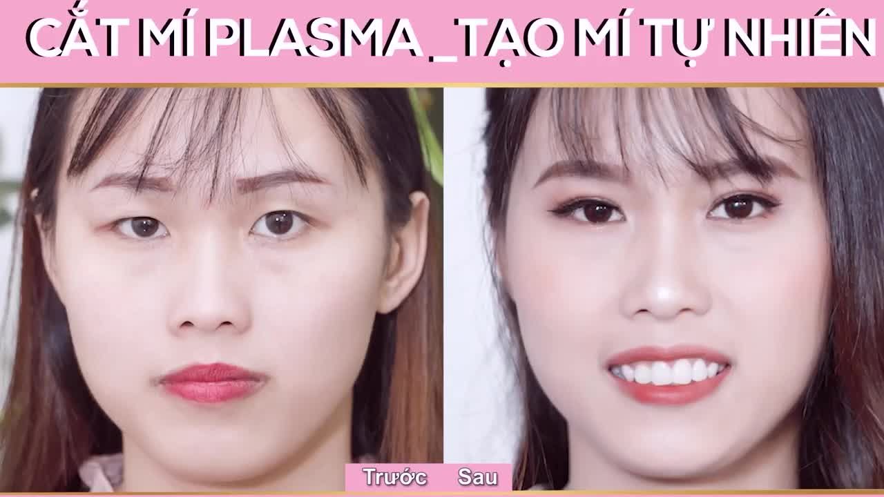 Cùng ca sĩ Việt Quang gặp gỡ bác sĩ Long để tìm hiểu các kiến thức liên quan đến phương pháp tạo mắt 2 mí .