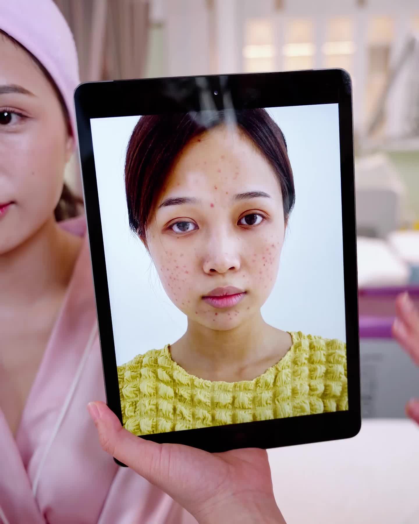 Hà My nhận cái kết ngọt ngào sau liệu trình trị mụn Acne Medic tại Hồng Ngọc