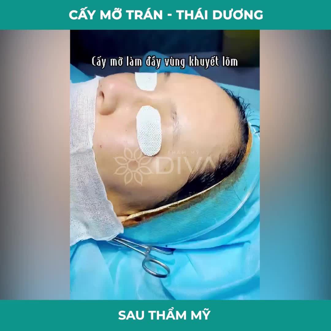 TRÁN, THÁI DƯƠNG HÓP PHƯƠNG PHÁP NÀO ĐIỀU TRỊ TỐT