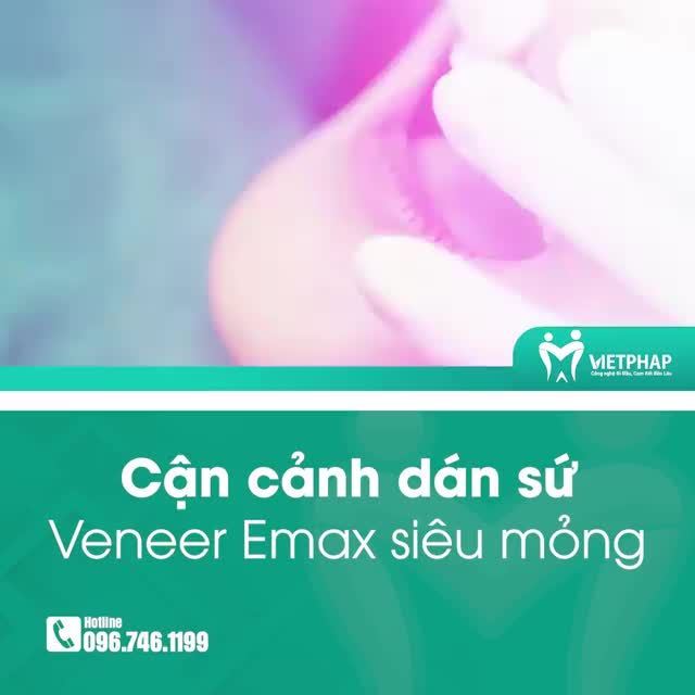BỌC RĂNG SỨ GIỮ LẠI THANH XUÂN
