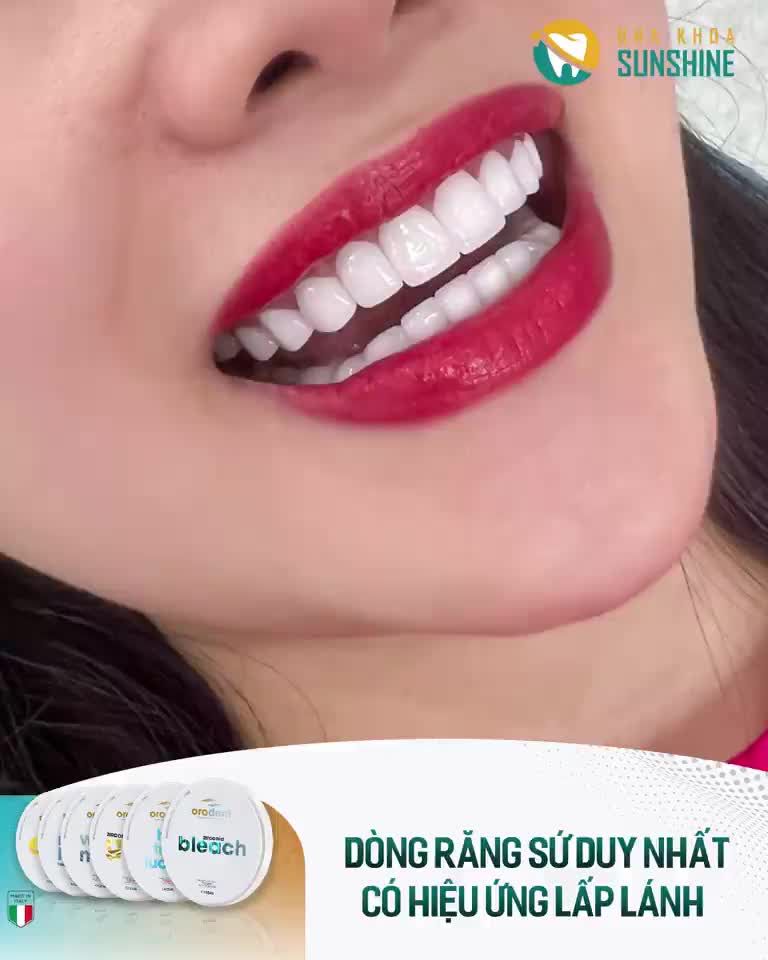 Ca sĩ Trịnh Huyền hoàn toàn hài lòng với  Dòng răng toàn sứ an toàn nhất thế giới