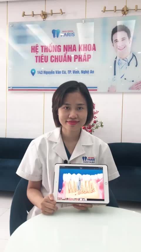 Cần phải làm gì sau khi cấy ghép trụ Implant trong phục hình răng mất bằng phương pháp Implant