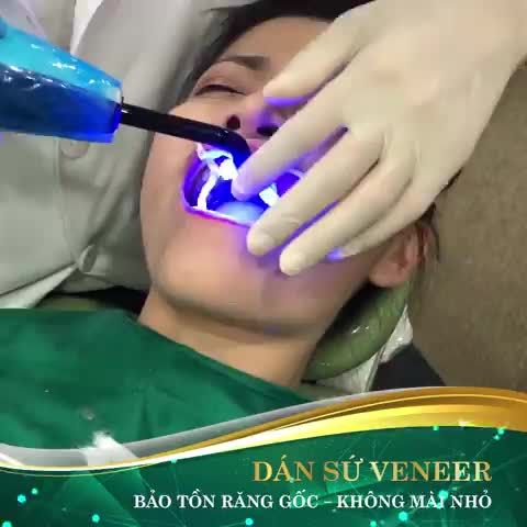 CHỊ ẤY ĐÃ SẴN SÀNG ĐỂ KHOE HÀM RĂNG TRẮNG SÁNG, NỤ CƯỜI TỰ TIN