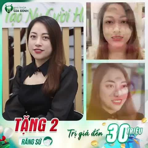 Chị Hiền luôn cảm thấy thiếu tự tin với nụ cười khiếm khuyết, răng ố vàng, hình thể không đẹp khiến chị không thoải mái khi cười.