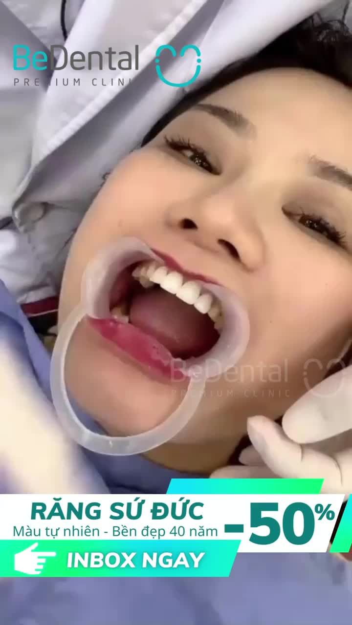 Chờ mãi cũng đến ngày lắp răng, thay đổi nụ cười