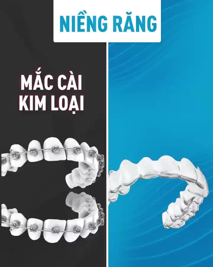 Chọn Niềng Răng Trong Suốt hay Mắc Cài