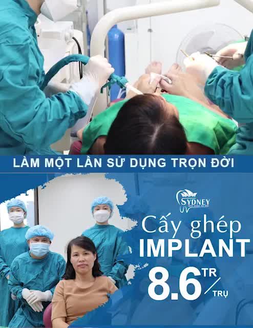 CÓ HAY KHÔNG- NÊN TRỒNG RĂNG IMPLANT