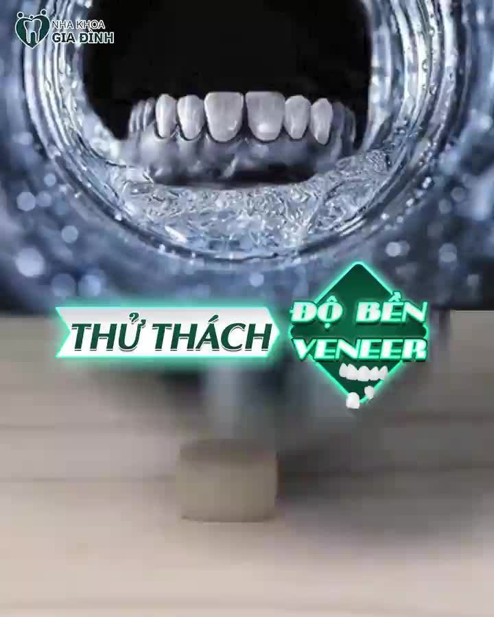 Đảm bảo khách hàng khi Dán sứ Veneer tại Nha khoa Gia Đình cho độ bền tuyệt đối