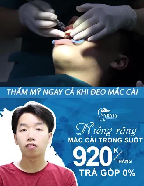 ĐỪNG ĐỂ MẤT THỜI GIAN KHI NIỀNG RĂNG SAI CHỖ